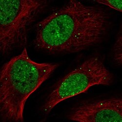 ZNF638 Antibody, Novus Biologicals 25 &mu;L; Unlabeled:Antibodies, Polyclonal
